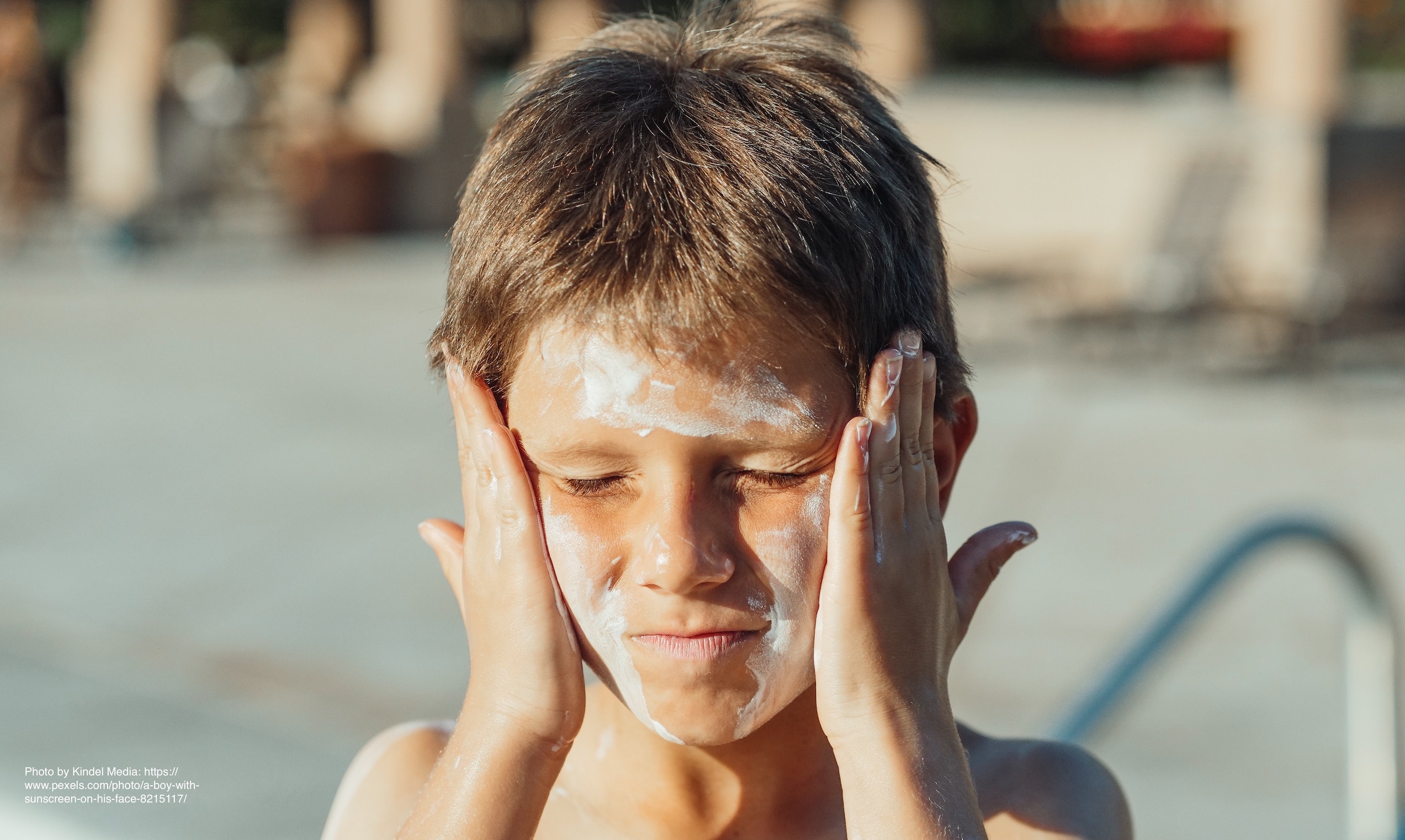 Looking after your skin in hot weather