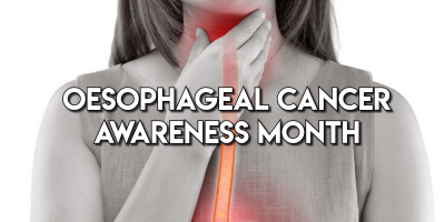 Oesophageal Cancer – Don’t Ignore Ongoing Swallowing or Heartburn Problems